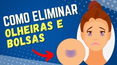 Como Se Livrar de OLHEIRAS, BOLSAS NOS OLHOS e INCHAÇO!