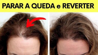 QUEDA DE CABELO EM MULHERES - A forma mais rápida de PARAR e REVERTER