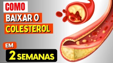 Como BAIXAR O COLESTEROL em 2 SEMANAS - Naturalmente! (Sem Remédios)