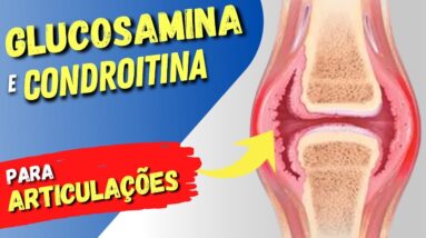 GLUCOSAMINA E CONDROITINA para Articulações - Como Funciona, Para Que Serve e Cuidados