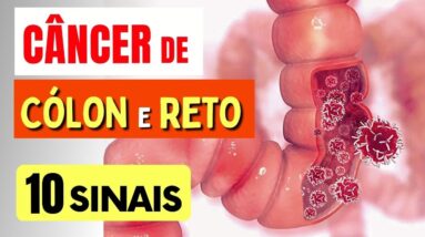 10 SINAIS de Alerta para CÂNCER de CÓLON e RETO que Todos Deveriam Saber