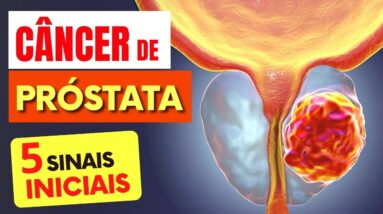 5 SINAIS de Alerta para CÂNCER de PRÓSTATA que Todos Deveriam Saber