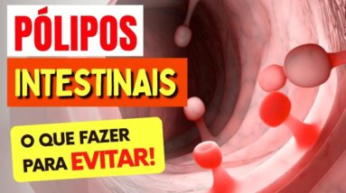 Como Evitar PÓLIPOS INTESTINAIS - O Que Você PRECISA SABER!