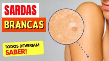 SARDAS BRANCAS - Coisas que TODO MUNDO DEVERIA SABER!