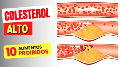 10 Alimentos PROIBIDOS para COLESTEROL ALTO (e Como BAIXAR o COLESTEROL RAPIDO)