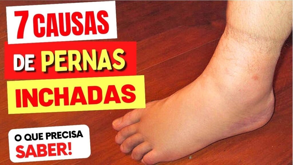 7 Causas de PERNAS INCHADAS e O QUE FAZER – Você PRECISA VER ISSO ...
