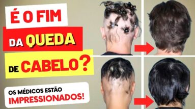 BARICITINIBE - É O FIM DA QUEDA DE CABELO? Por que os Médicos estão Impressionados?