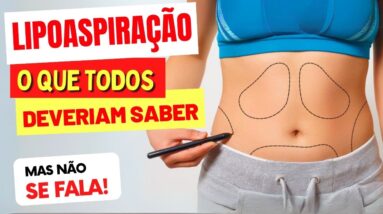 LIPOASPIRAÇÃO - O que TODOS DEVERIAM SABER! (mas não se fala)