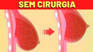 LEVANTAR OS SEIOS SEM CIRURGIA? Veja ISSO!