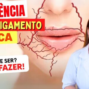 DORMÊNCIA e FORMIGAMENTO NA BOCA - O Que Pode Ser? O Que Fazer?