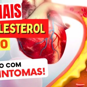 8 SINAIS de COLESTEROL ALTO - Cuidado com estes Sintomas!