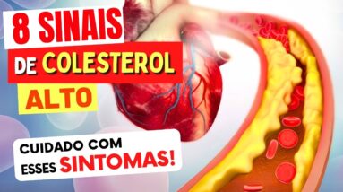 8 SINAIS de COLESTEROL ALTO - Cuidado com estes Sintomas!