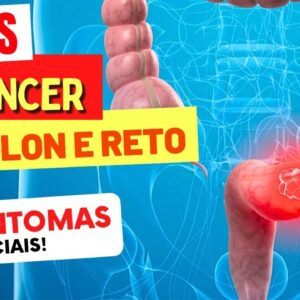 6 SINTOMAS INICIAIS de CÂNCER de CÓLON e RETO que você NÃO PODE IGNORAR!