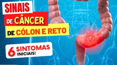 6 SINTOMAS INICIAIS de CÂNCER de CÓLON e RETO que você NÃO PODE IGNORAR!