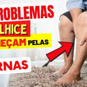 ATENÇÃO: Os PROBLEMAS DE VELHICE começam pelas PERNAS! Veja como EVITAR